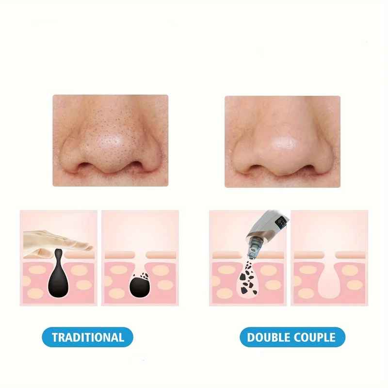 SkinVac™ Facial Pore Vacuum – Gentle, Powerful & Portable Skincare Tool