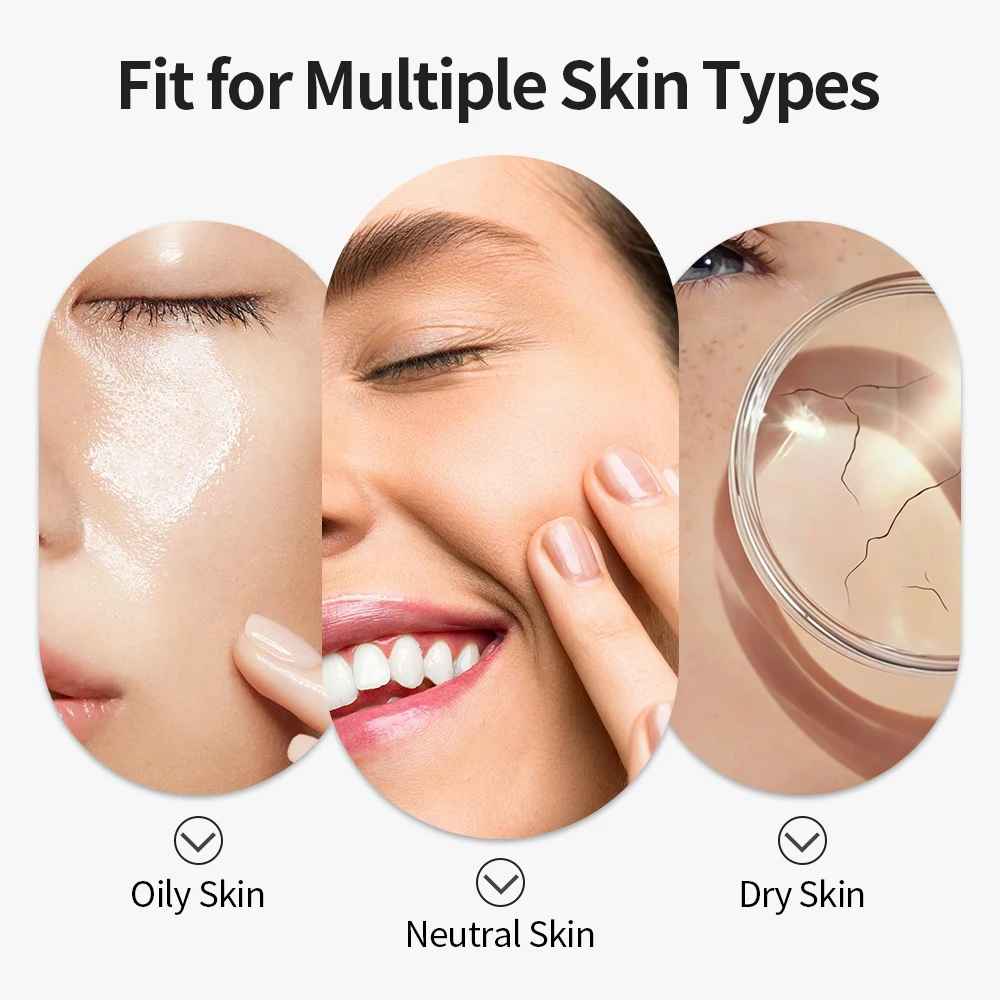 SkinVac™ Facial Pore Vacuum – Gentle, Powerful & Portable Skincare Tool