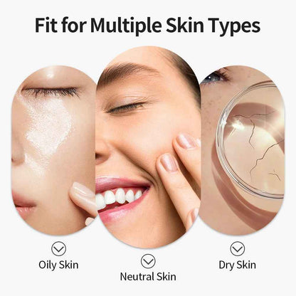 SkinVac™ Facial Pore Vacuum – Gentle, Powerful & Portable Skincare Tool